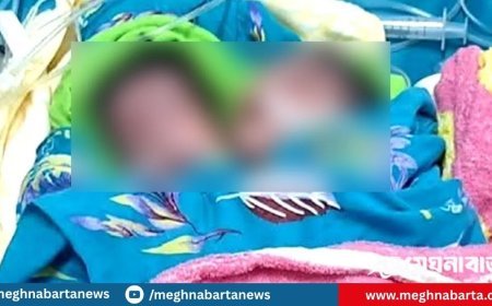 দুটি মাথা নিয়ে এক শিশুর জন্ম