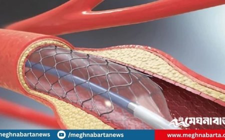 দাম কমলো হার্টের রিংয়ের