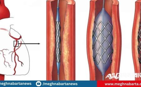 হার্টের রিংয়ের নতুন দাম কার্যকর ১ অক্টোবর থেকে