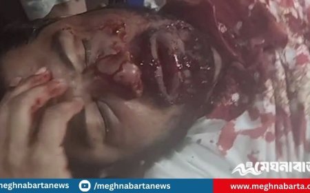 নুরের ওপর হামলা, রাতেই বিক্ষোভের ডাক এনসিপির