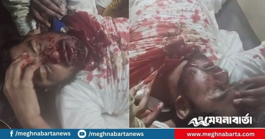গণঅধিকার পরিষদ ও আইন শৃঙ্খলা বাহিনীর সং'ঘ'র্ষে গুরুতর আ'হ'ত নুরুল হক নুর