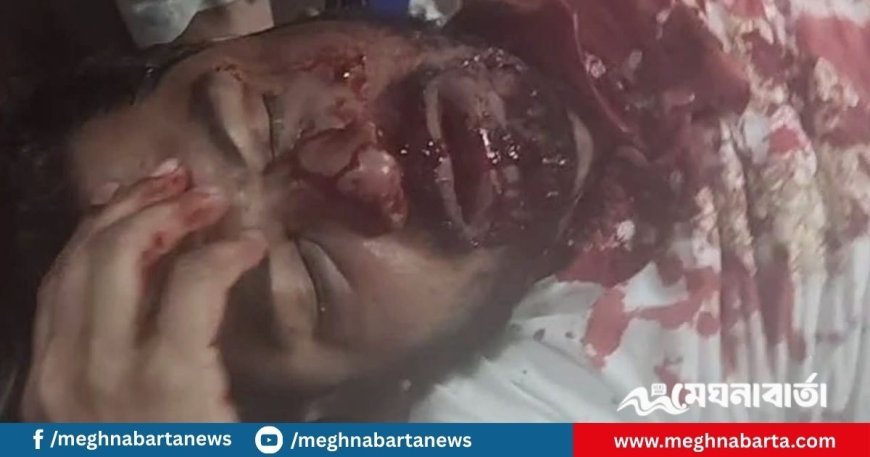 নুরের ওপর হামলা, রাতেই বিক্ষোভের ডাক এনসিপির