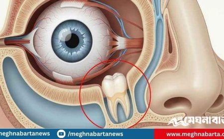 চিকিৎসা বিজ্ঞানের বিস্ময়, চোখে গজালো দাঁত