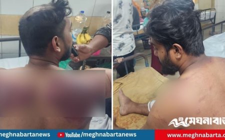 জামিনে বেরিয়ে আবারও বিএনপি নেতাকর্মীদের পেটালেন যুবলীগ নেতা