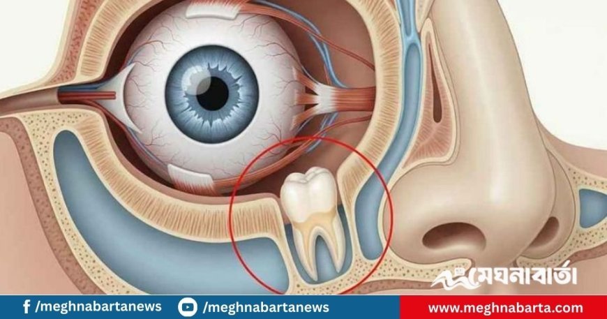 চিকিৎসা বিজ্ঞানের বিস্ময়, চোখে গজালো দাঁত