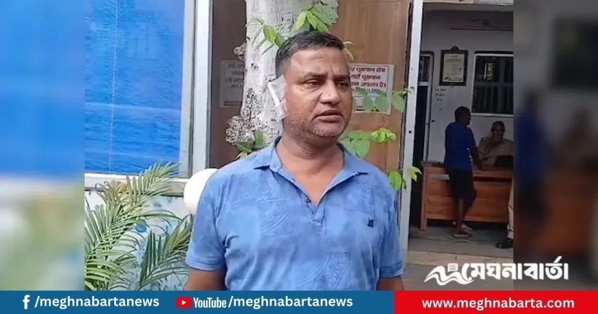 স্বামীর কান কামড়ে ছিঁড়ে নিলেন স্ত্রী