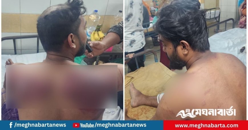 জামিনে বেরিয়ে আবারও বিএনপি নেতাকর্মীদের পেটালেন যুবলীগ নেতা