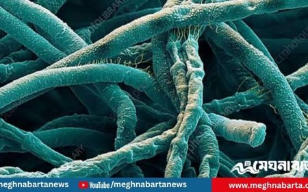 অ্যানথ্রাক্স প্রতিরোধে সমন্বিত কার্যক্রম শুরু