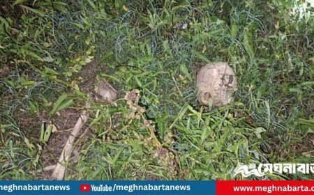 নড়াইলে কচুরিপানার ভেতর মানুষের মাথার খুলি ও হাড়গোড়