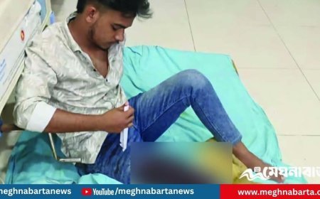 কক্সবাজারে বেড়াতে এসে ছিনতাইকারীর হাতে রক্তাক্ত টাঙ্গাইলের সাইফুল