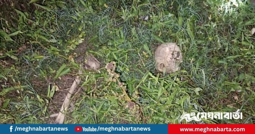 নড়াইলে কচুরিপানার ভেতর মানুষের মাথার খুলি ও হাড়গোড়