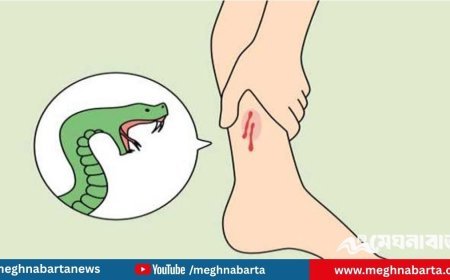 সব উপজেলায় সাপের কামড়ের অ্যান্টিভেনম পৌঁছে দেওয়ার নির্দেশনা