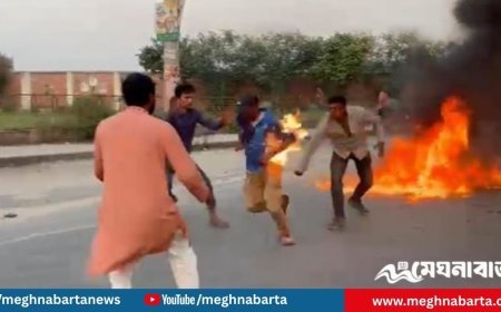 বিক্ষোভকালে টায়ারে আগুন পোড়াতে গিয়ে নিজেই পুড়লেন সাবেক ছাত্রদল নেতা