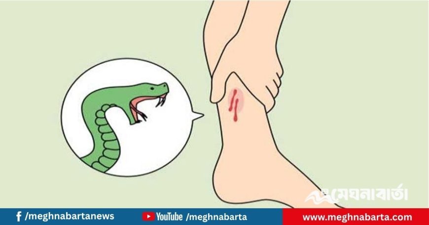 সব উপজেলায় সাপের কামড়ের অ্যান্টিভেনম পৌঁছে দেওয়ার নির্দেশনা