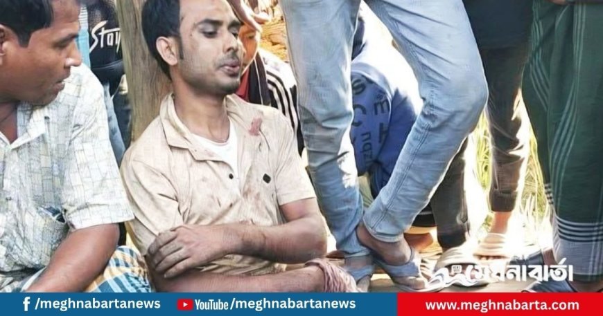 চোর সন্দেহে যুবদল নেতার পা ভেঙে দিল স্থানীয়রা