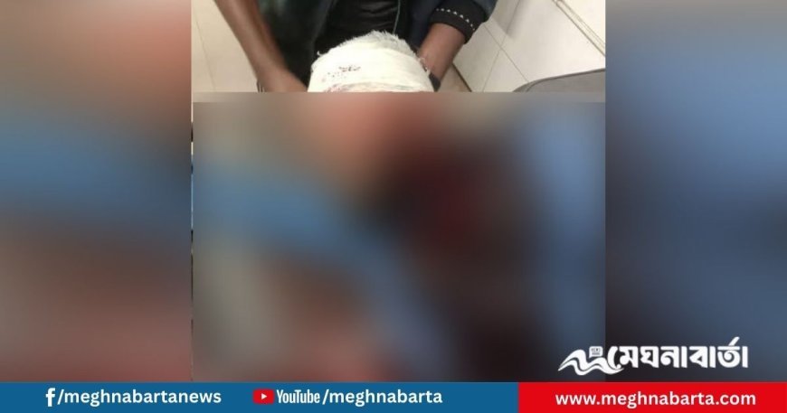 খুলনায় এনসিপি নেতাকে গুলি, অবস্থা আশঙ্কাজনক